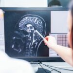 Types of Brain Injuries
