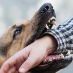 Dog Bite Lawsuit Cost