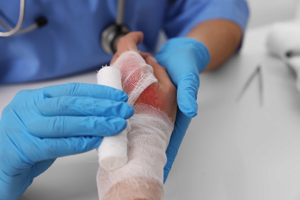 burn injury being treated 