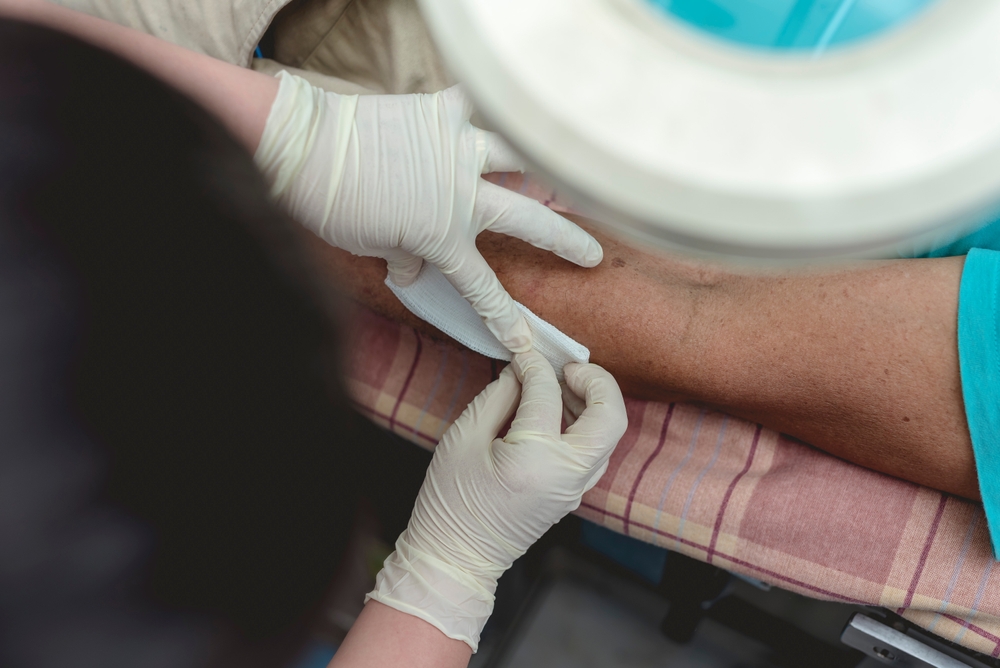 Close-up of a medical worker wearing gloves treating a bite wound on a person’s leg.